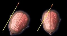 UNA PENTOLA SENZA COPERCHIO